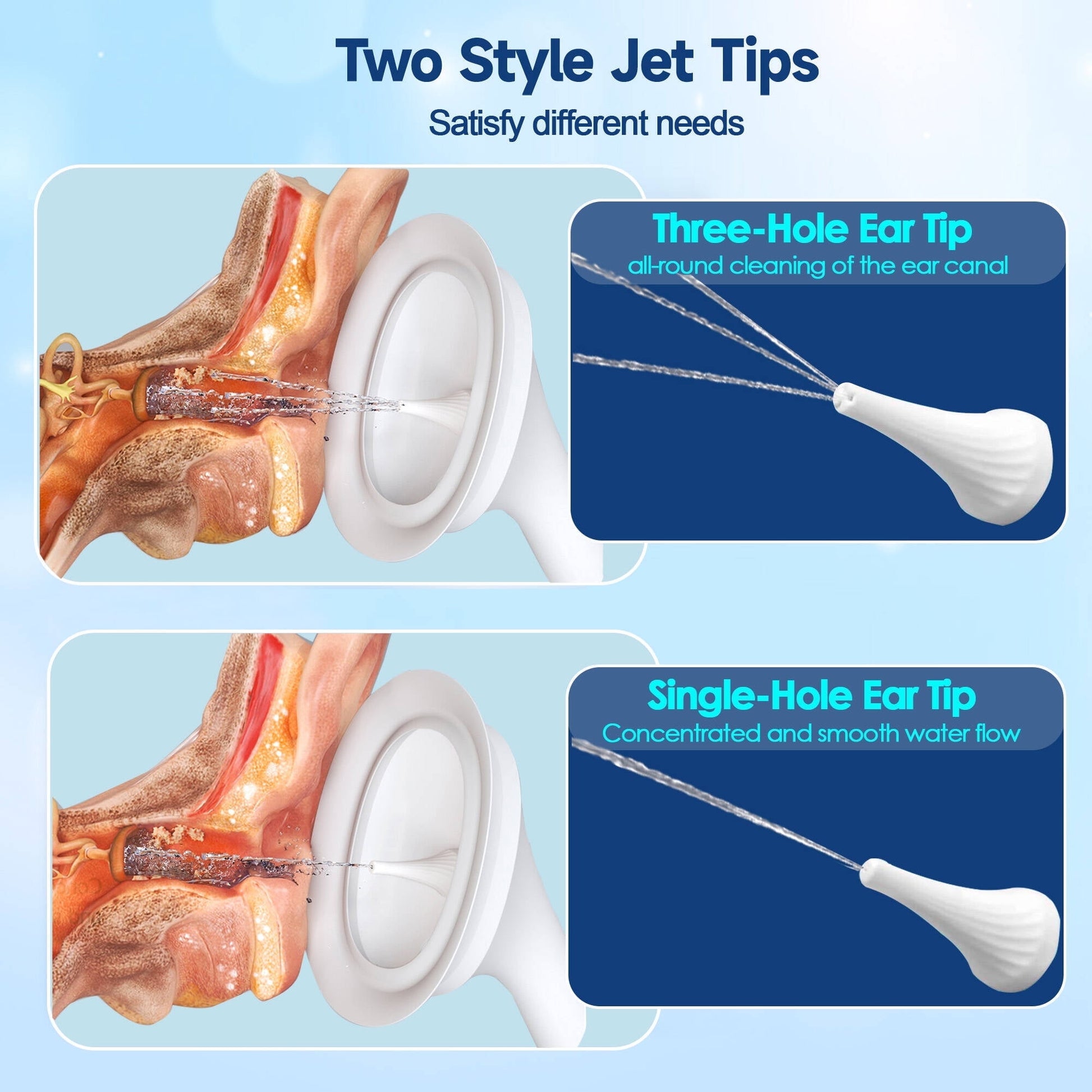 Morfone Ear Wax Removal Kit, Ear Cleaner with One-Piece Waste Tank, 4 Pressure Mode,2 Style Tips, Effective Ear Irrigation Flushing System & USB-C Cable, IPX6, White
