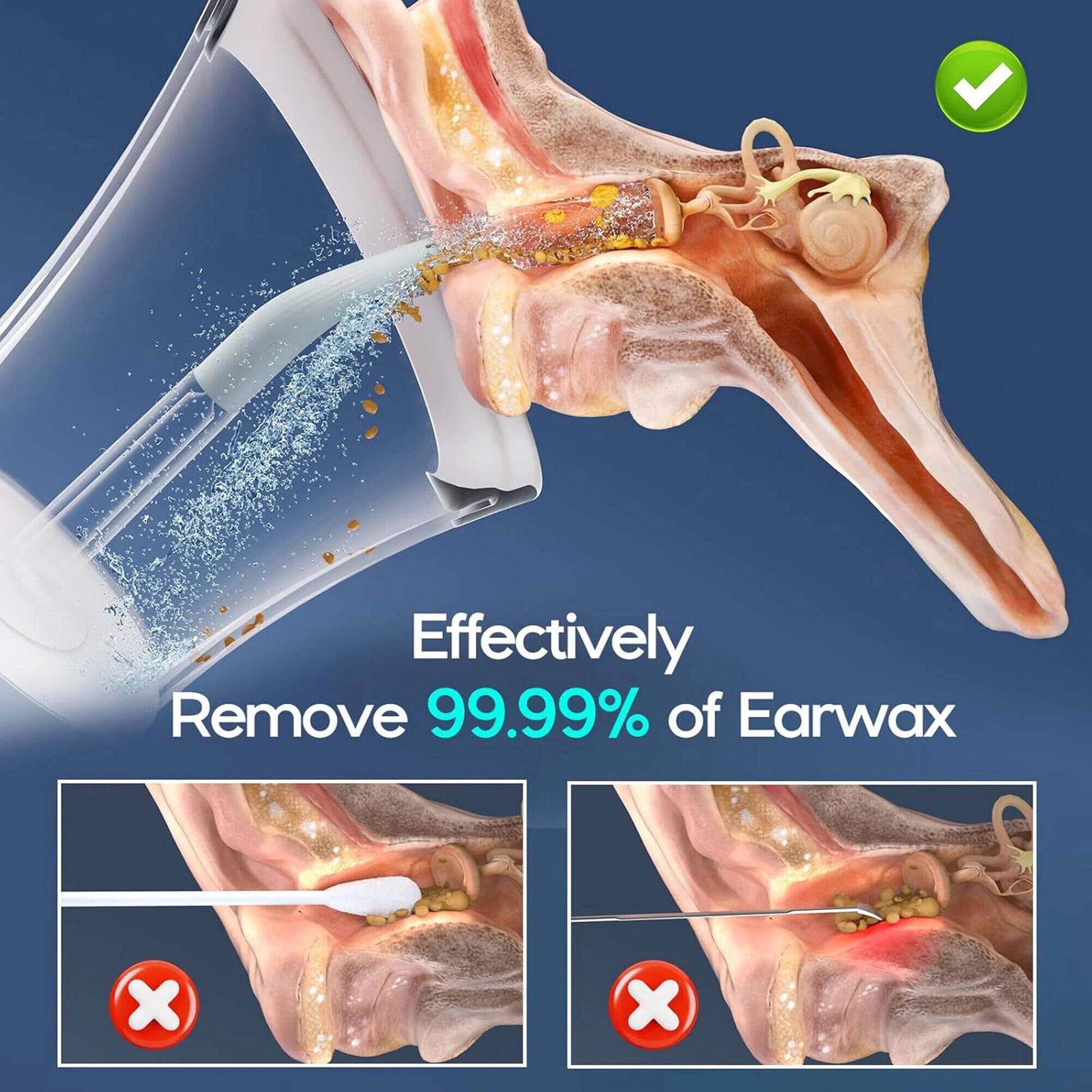 Morfone Ear Wax Removal with One-Piece Waste Tank, Ear Cleaner with Water Temperature Sensor, 4 Pressure Settings, Ear Cleaning Kit for Ear Wax Buildup & USB-C Cable, IPX6