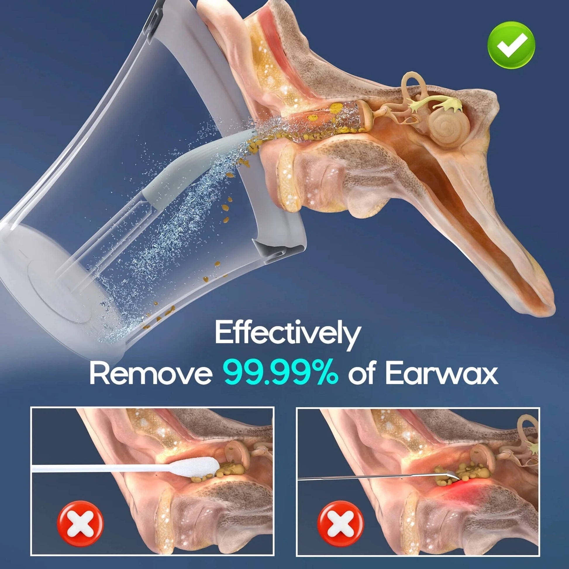 Morfone Ear Wax Removal with One-Piece Waste Tank, Ear Cleaner with Water Temperature Sensor, 4 Pressure Settings, Ear Cleaning Kit for Ear Wax Buildup & USB-C Cable, IPX6