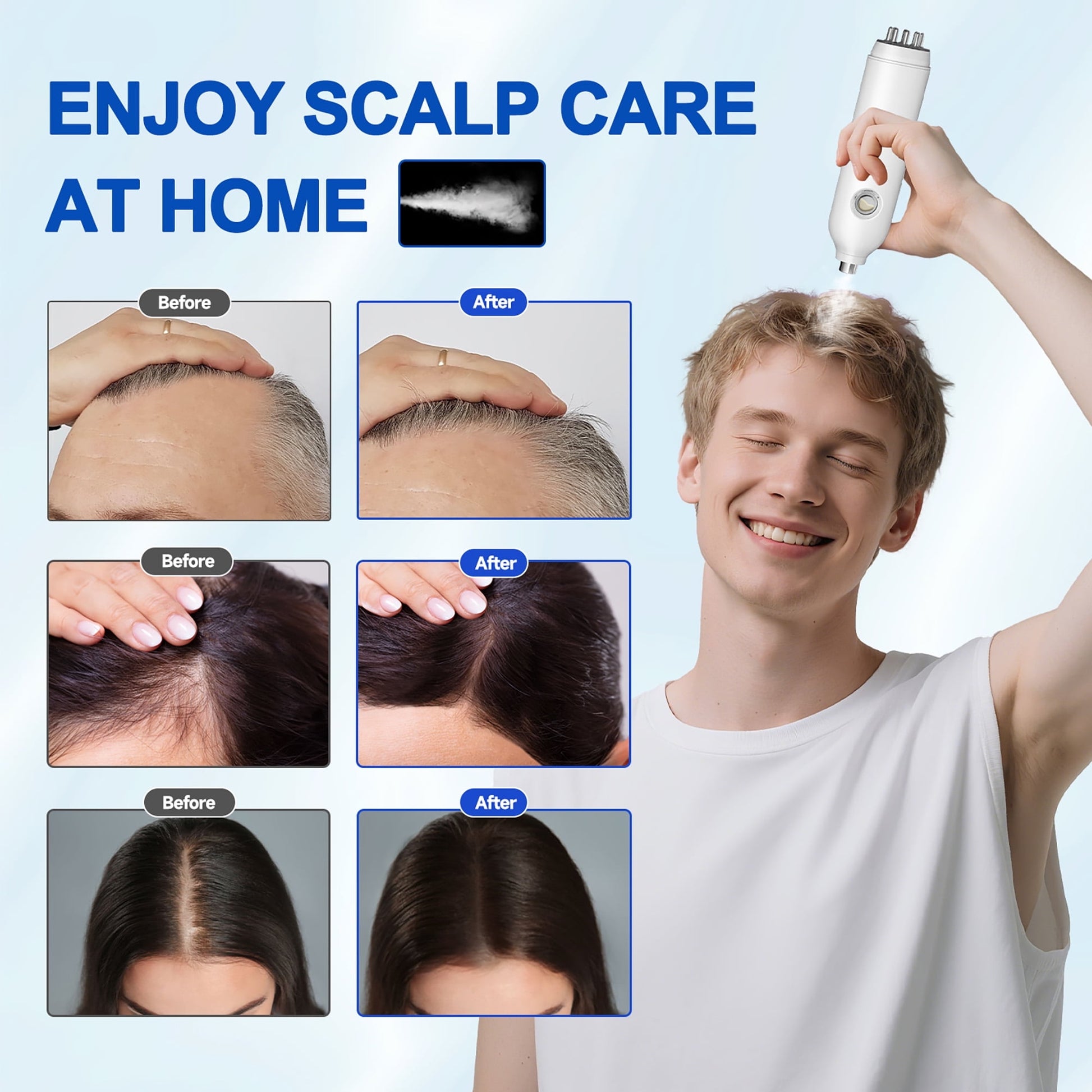 Morfone 3 in 1 Dual Head Electric Minoxidil Applicator and Scalp Massager Brush for Hair Growth, White