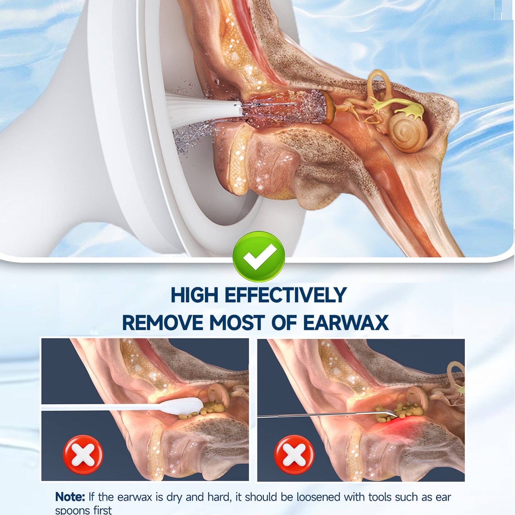 Morfone Ear Wax Removal Kit, Ear Cleaner with One-Piece Waste Tank, 4 Pressure Mode,2 Style Tips, Effective Ear Irrigation Flushing System & USB-C Cable, IPX6, White