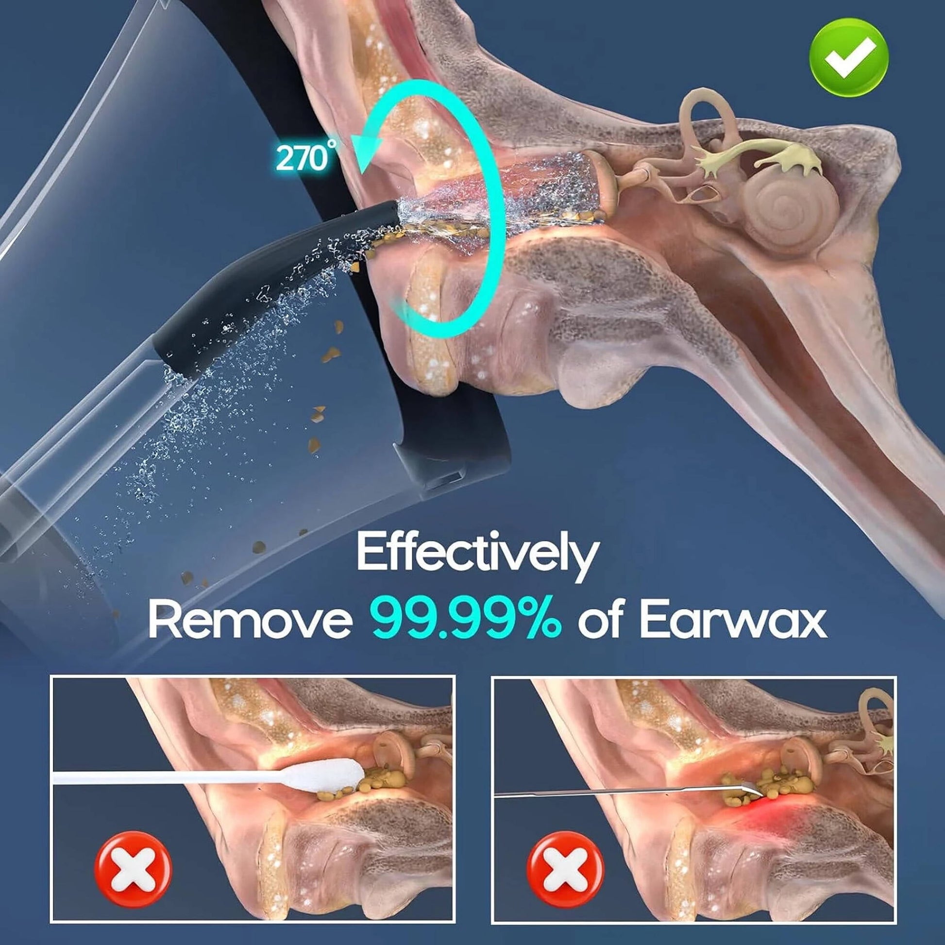 Morfone Ear Wax Removal with One-Piece Waste Tank, Ear Cleaner with Water Temperature Sensor, 4 Pressure Settings, Ear Cleaning Kit for Ear Wax Buildup & USB-C Cable, IPX6